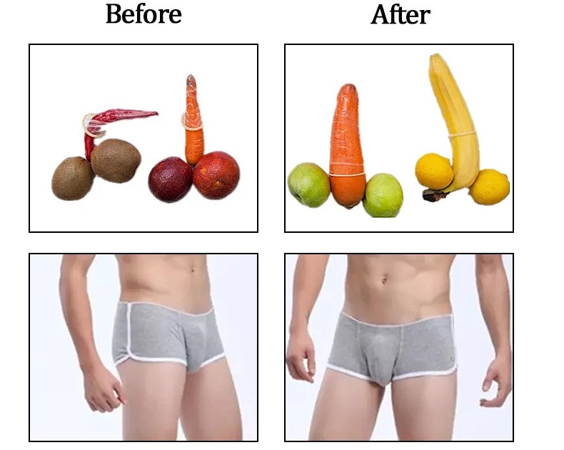 10ml 20mlSafety Lasts Long Acido Crosslinked Hyaluronic Acid Male Penis Enlargement Injections