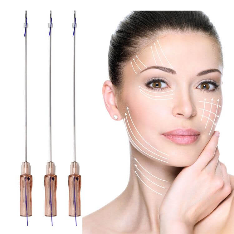 Non-Surgical Absorbable Pdo Face Lifting Thread For Skin Tightening And Lifting