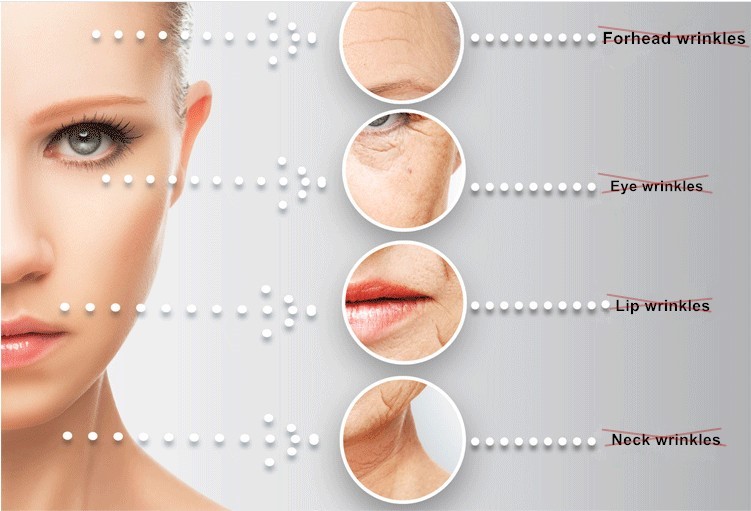 Handheld Mini Hifu Face Lift Machine Hifu Beauty Home 