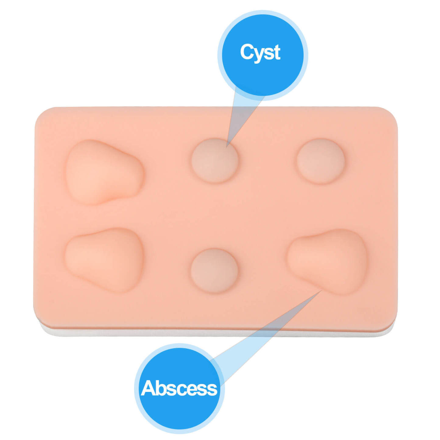 Ultrassist Skin Practice Pad with Abscess & Cyst Embedded for I&D Practice