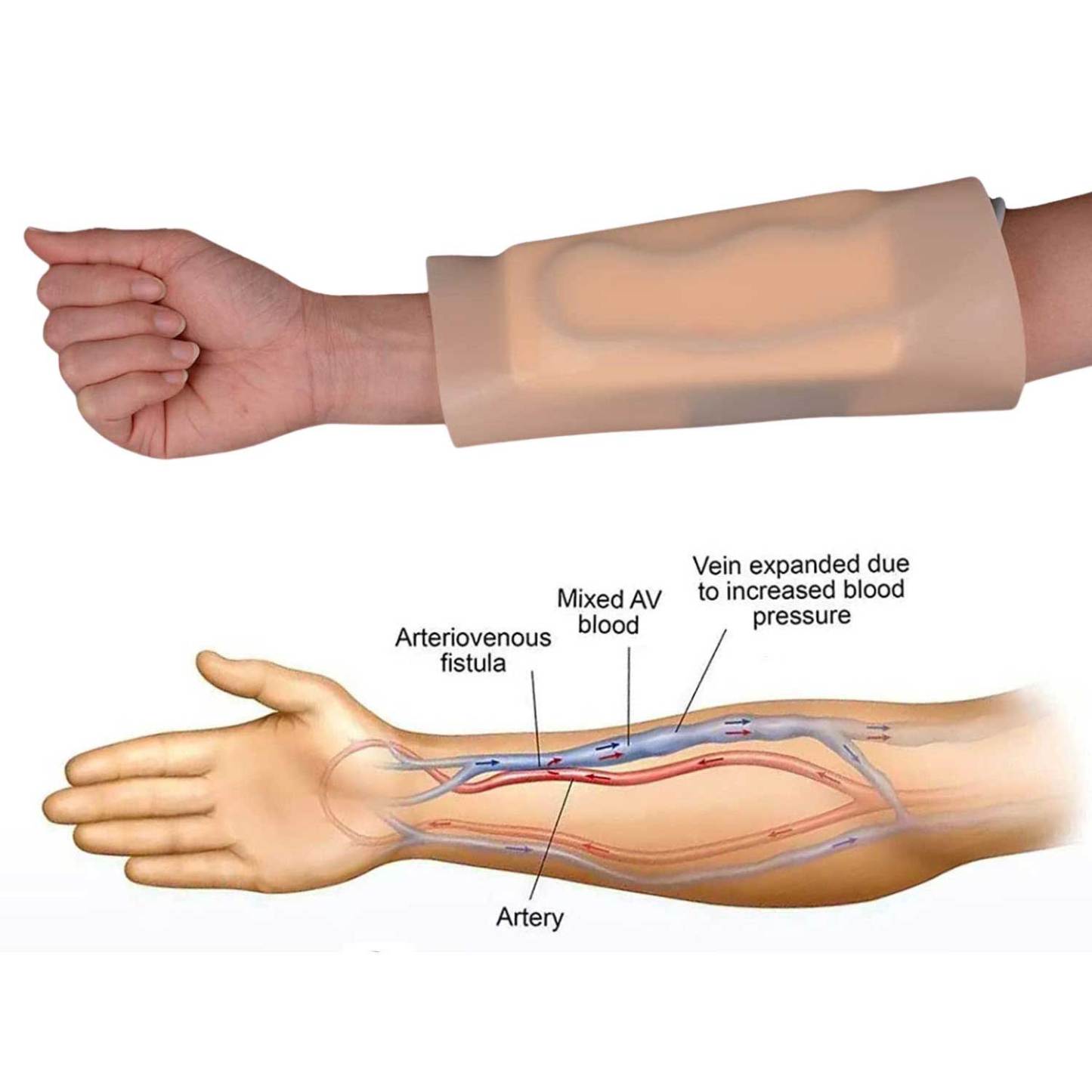 Realistic IV Sleeve Trainer