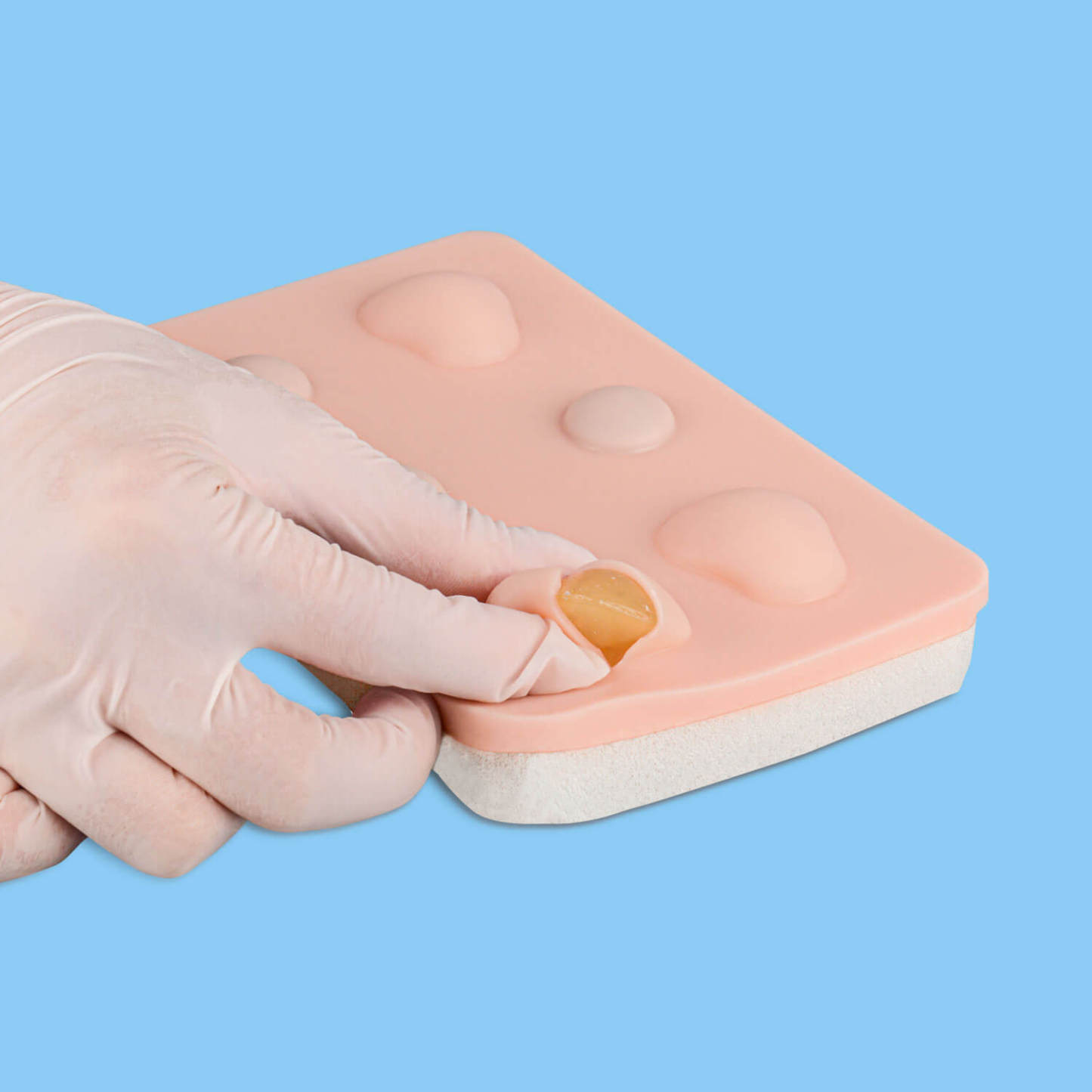 Abscess Incision and Drainage Pad