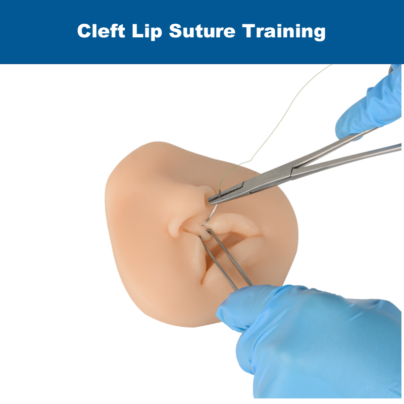 Ultrassist Cleft Lip Model for Repair Suture Training