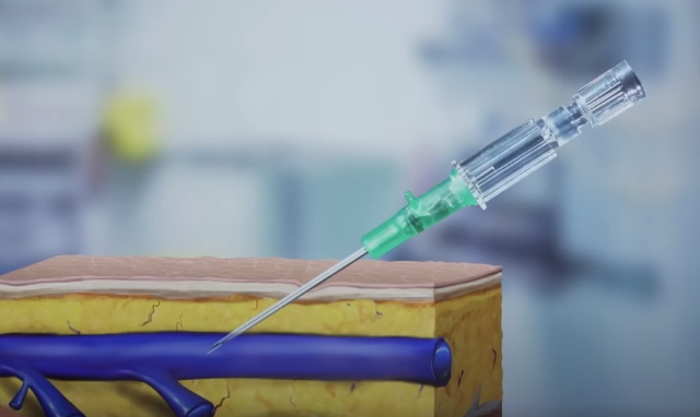 Top 3 Mistakes Lead to Your IV Access Failure