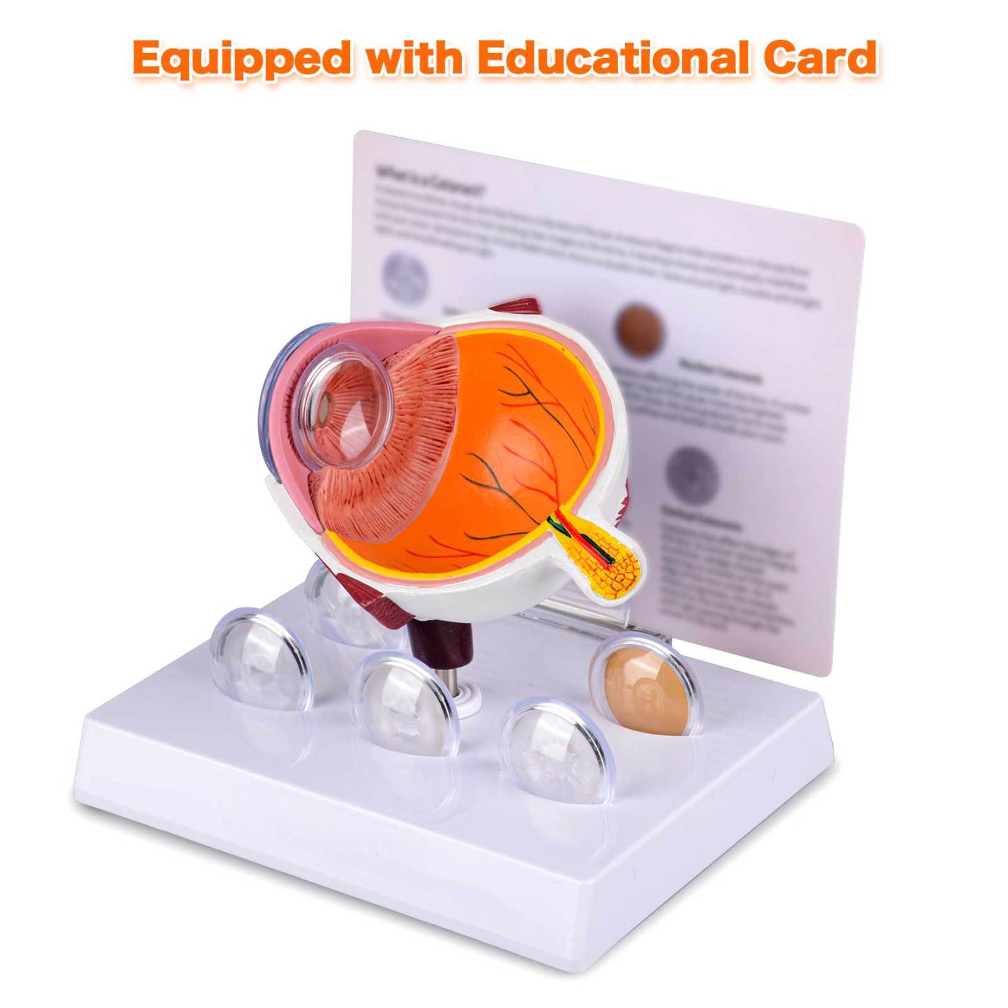 Enlarged Size Cataract Eye Model Equipped with Educational Card