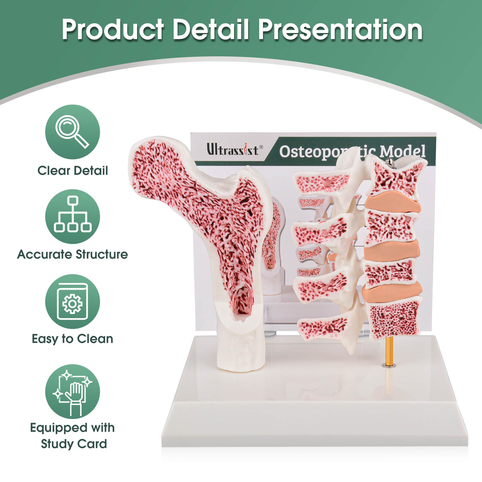 Ultrassist Osteoporosis Model with Clear Details for Teaching Demonstration