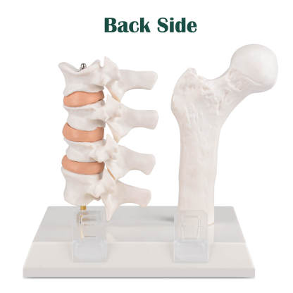 Ultrassist Osteoporosis Model Back Side