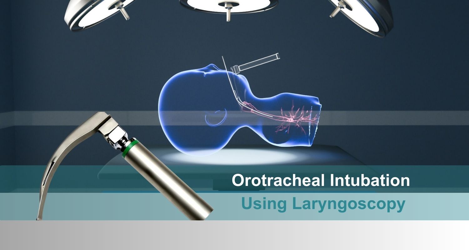 How to Do Orotracheal Intubation Using Laryngoscopy