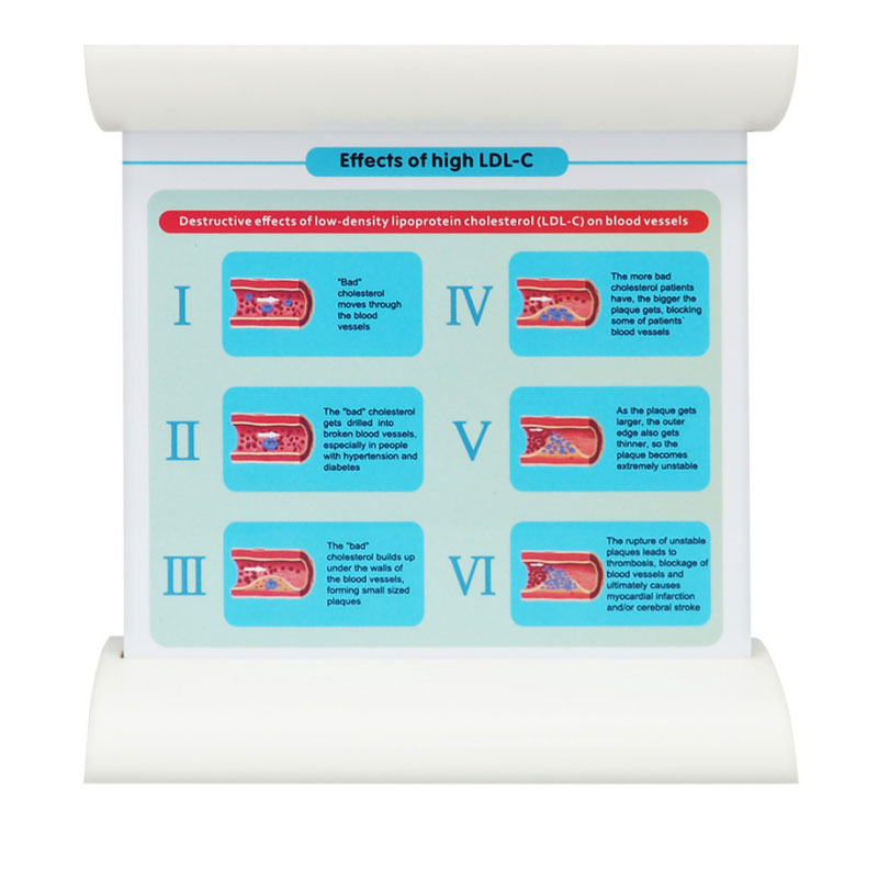 Lipoprotein LDL Blood Vessel Model Low Density Blood Lipid Vessel Obstruction