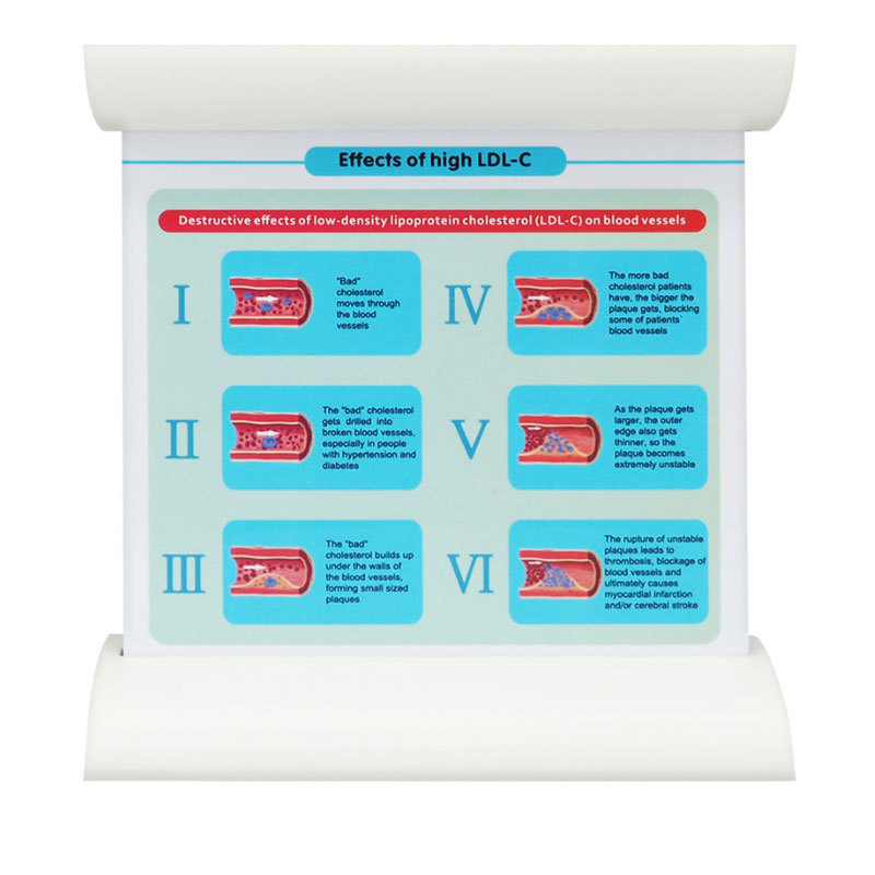 Lipoprotein LDL Blood Vessel Model Low Density Blood Lipid Vessel Obstruction