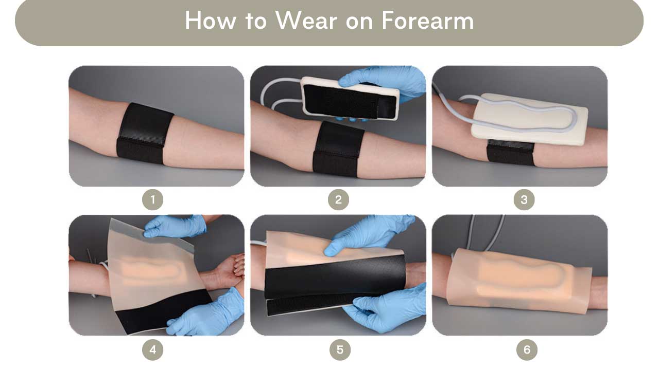 Comment porter un manchon IV sur l'avant-bras ?