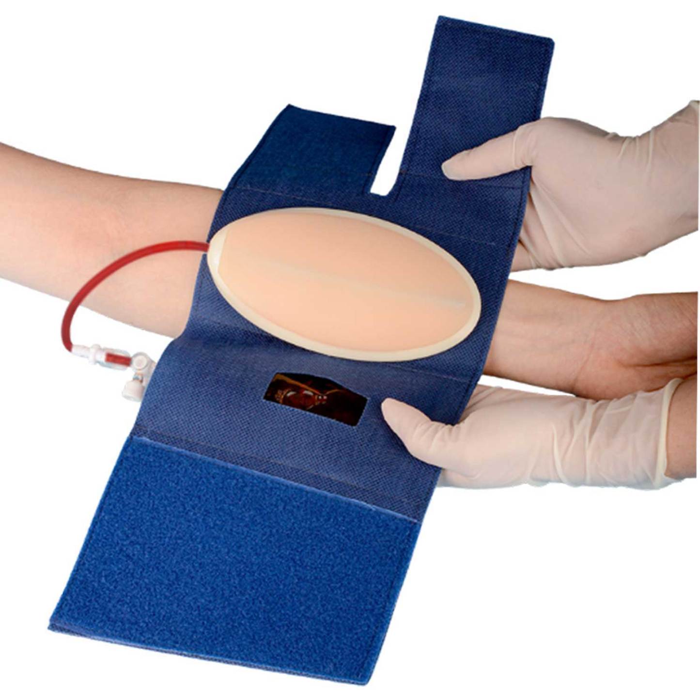 Ultrassist Wearable IV Insertion Practice Kit for Nursing Students