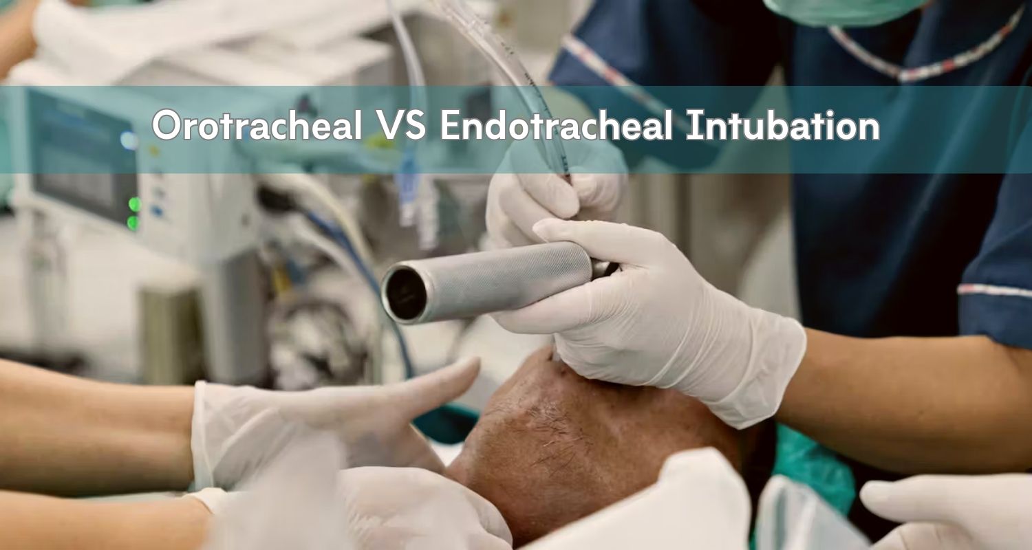 Orotracheal Intubation VS Endotracheal Intubation Ultrassist
