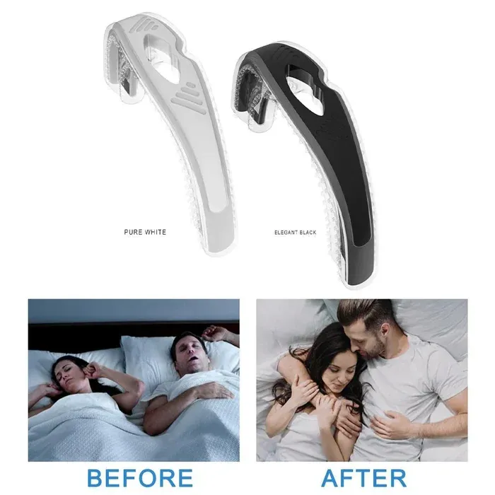 🌞Summer Promotion 60% OFF - Intendtdo™ Anti-Snoring Device Intendtdo™ Anti-Snoring Device-Topselling