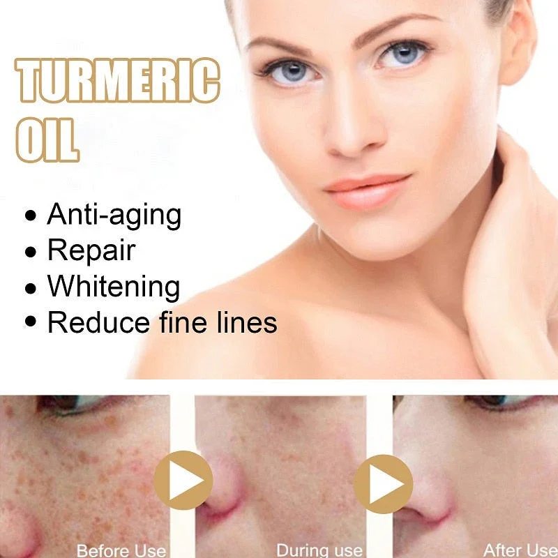 🔥Last Day Promotion 70% OFF - 🎉Turmeric Spot Correcting Serum-Topselling