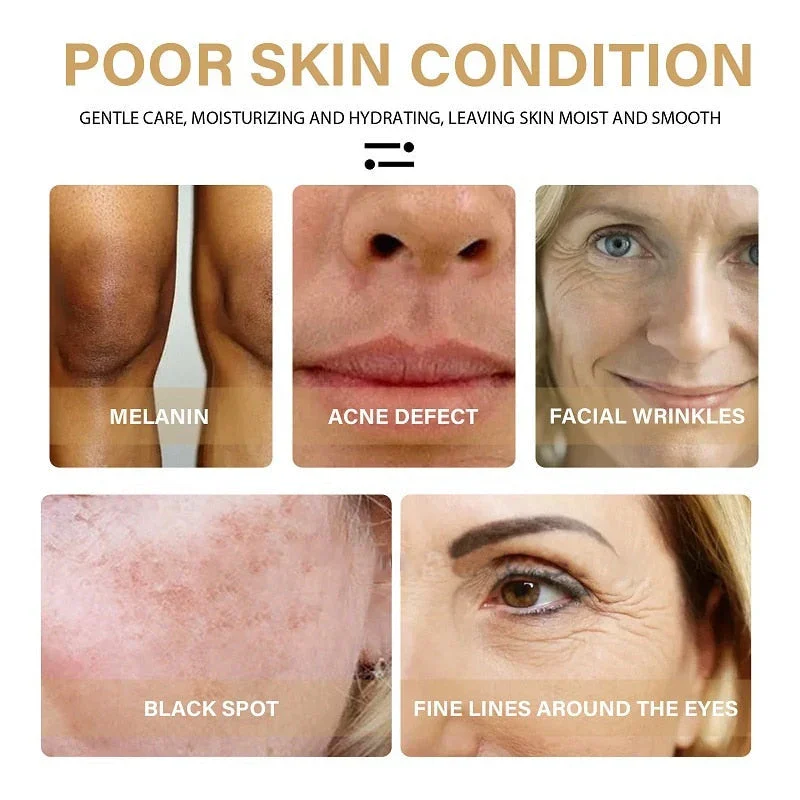 🔥Last Day Promotion 70% OFF - 🎉Turmeric Spot Correcting Serum-Topselling