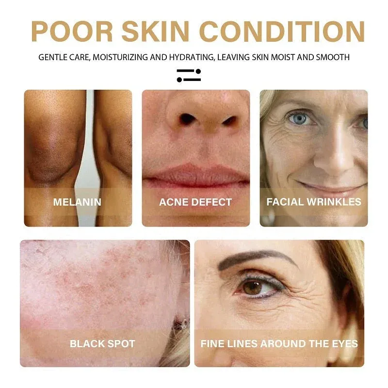 🔥Last Day Promotion 70% OFF - 🎉Turmeric Spot Correcting Serum-Topselling