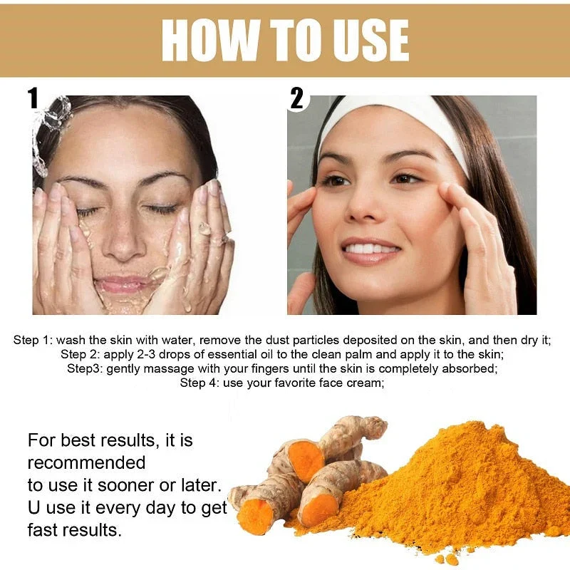🔥Last Day Promotion 70% OFF - 🎉Turmeric Spot Correcting Serum-Topselling