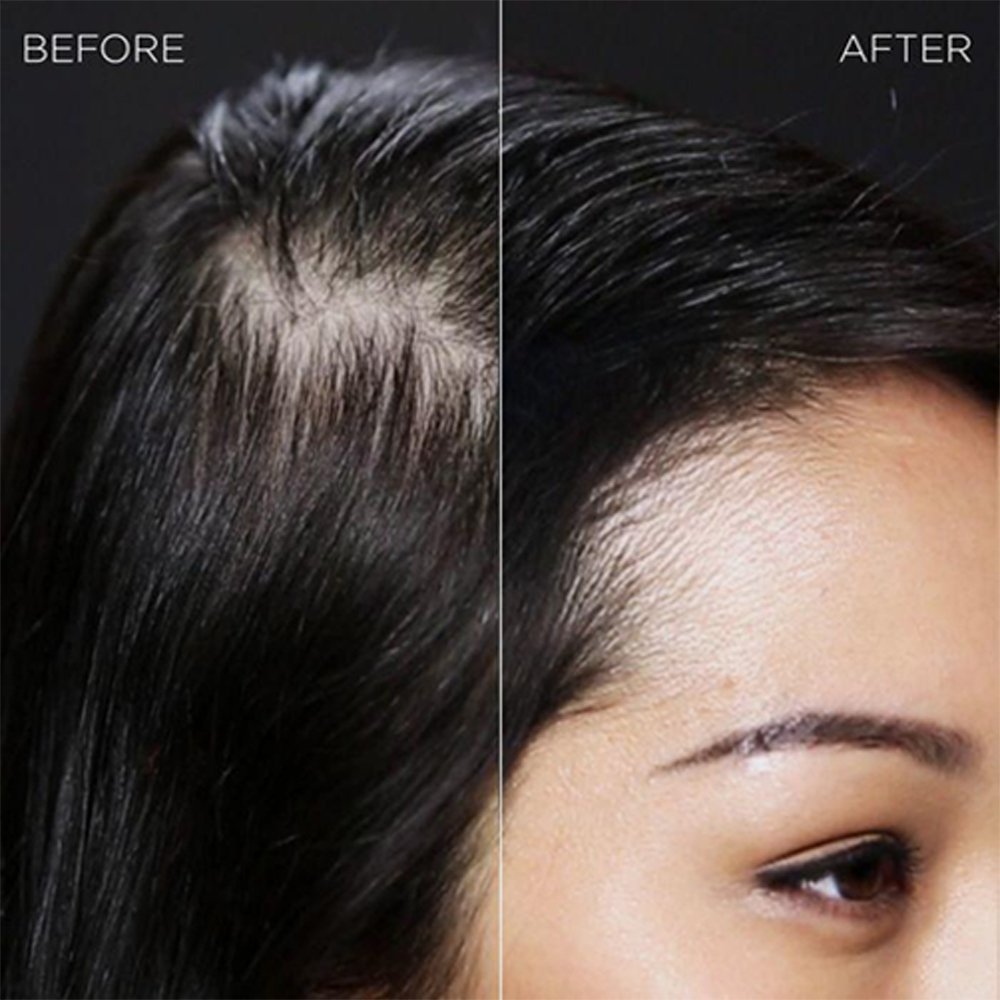 IMMETEE Hair Keratin Fiber for instant coverage of thinning hair-Topselling