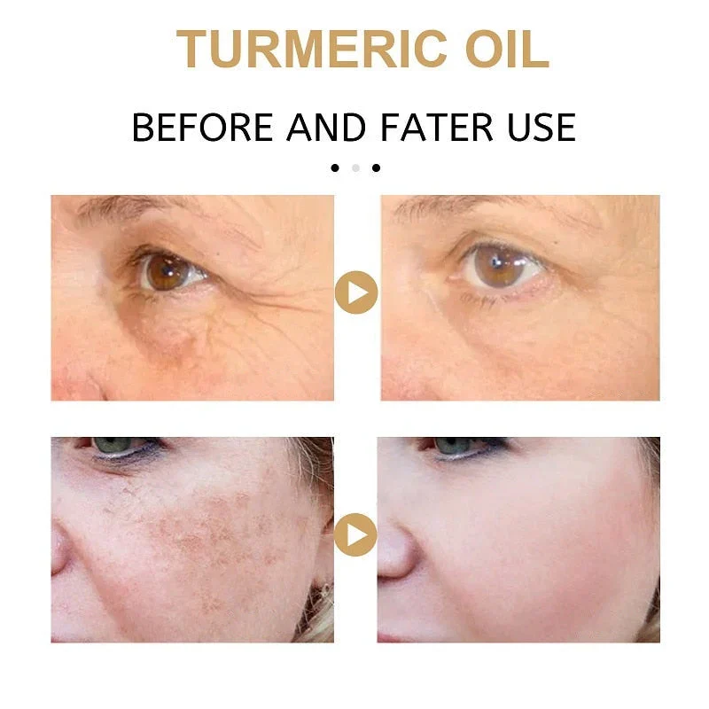 🔥Last Day Promotion 70% OFF - 🎉Turmeric Spot Correcting Serum-Topselling