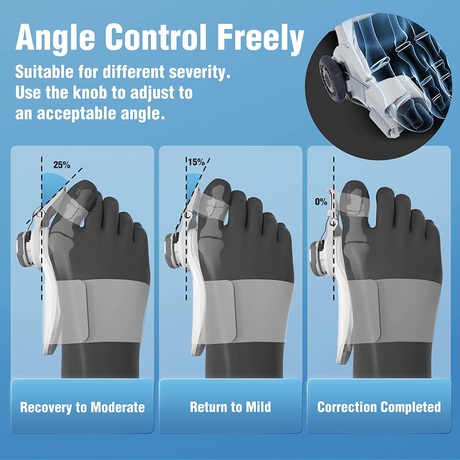  Bunion Corrector for Women and Men-24 Hours Care Day-night Support Kit-Topselling