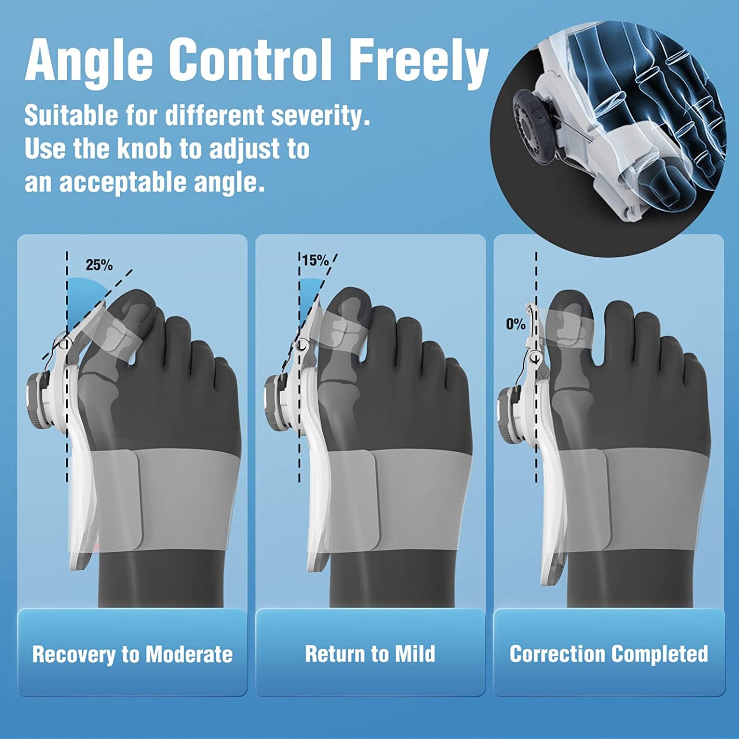  Bunion Corrector for Women and Men-24 Hours Care Day-night Support Kit-Topselling