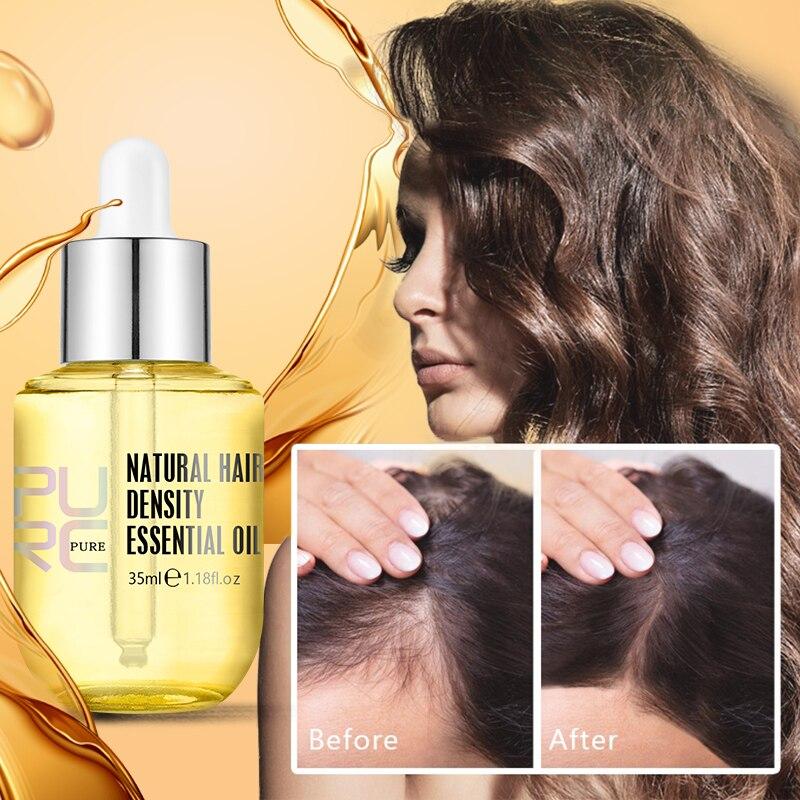 Last Day Promotion 70% OFF - 🔥 Hair Growth Oil