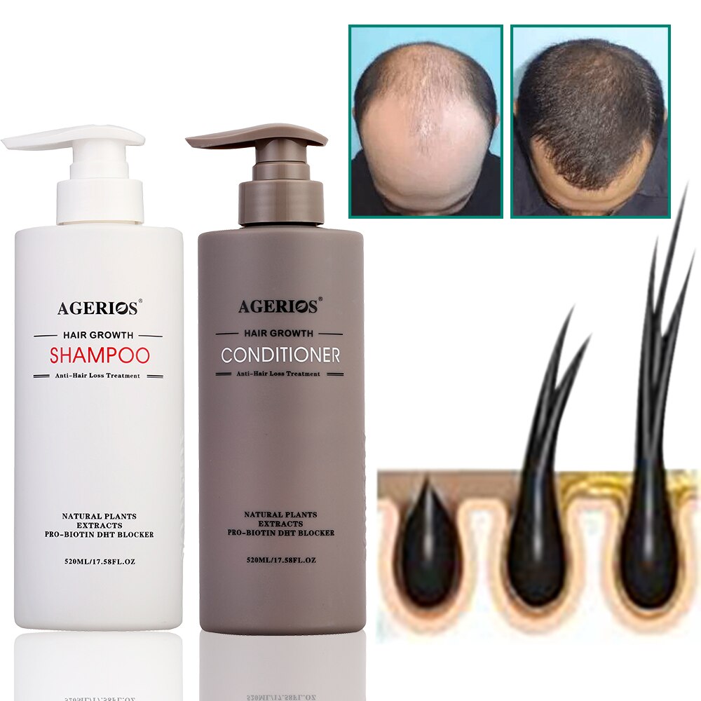 AGerios Organic Hair Growth Shampoo And Conditioner Anti Hair Loss 