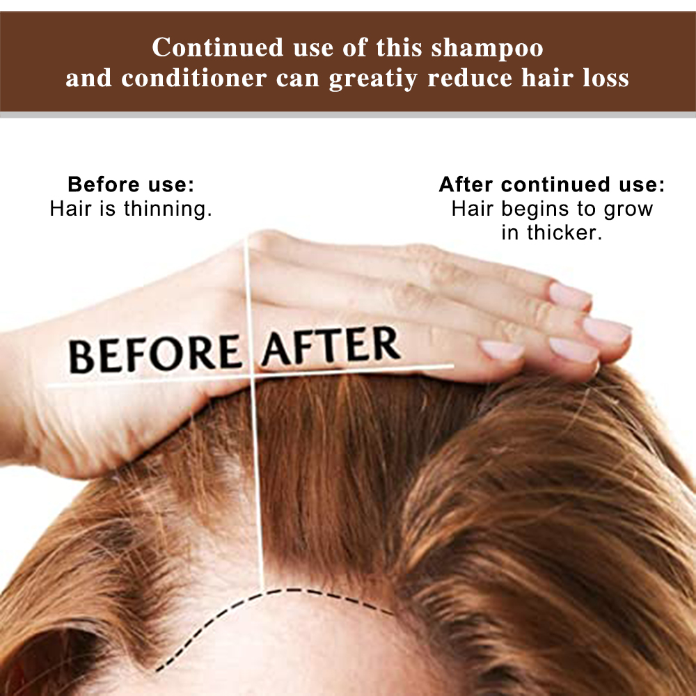 Classical Hair Growth Shampoo＆Conditioner