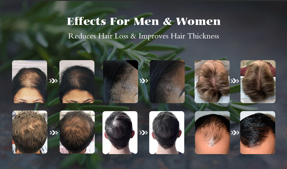 Istennők Hair Growth Oil