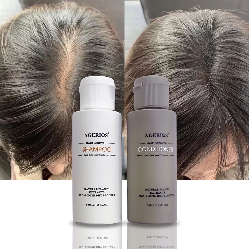 best shampoo for hair loss female