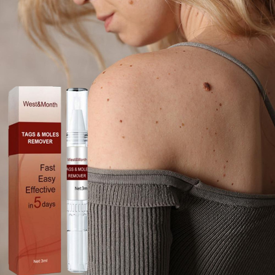 WipeOff Tags And Moles Remover