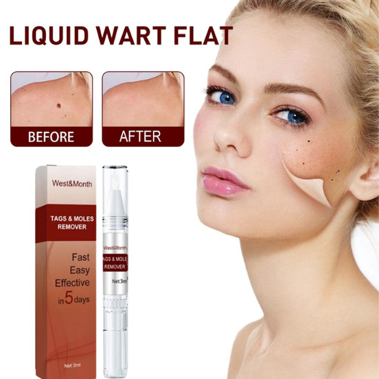 WipeOff Tags And Moles Remover