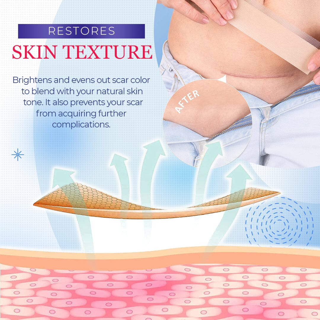 Silicone Scar Sheets