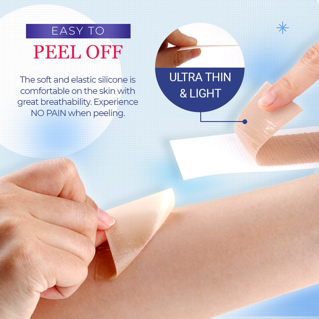 Silicone Scar Sheets