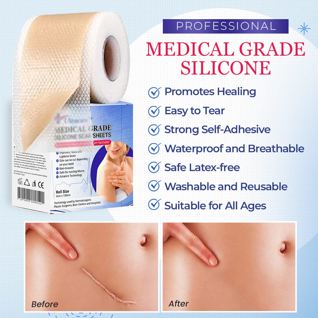 Silicone Scar Sheets