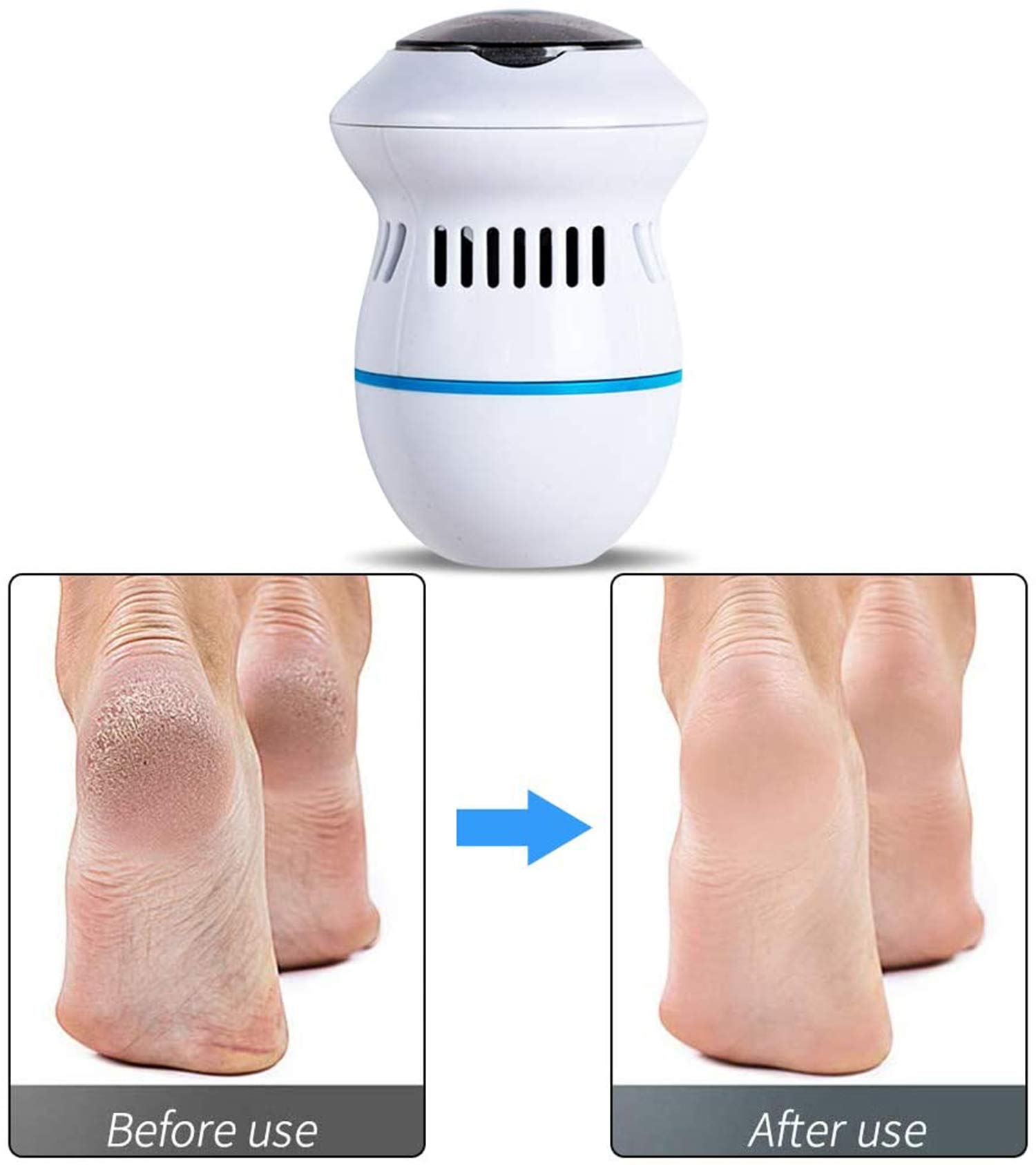 🔥HOT-SALE🔥 New Electric Foot Grinder Skin Hard Rupture Skin Trimmer Dead Skin