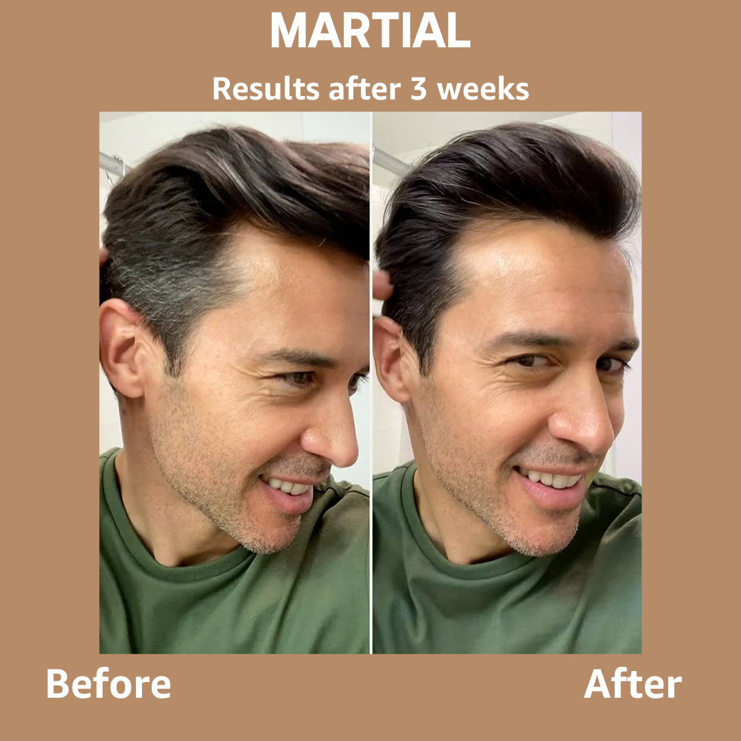 Keilini™ Gray Hair Bamboo Charcoal Bar