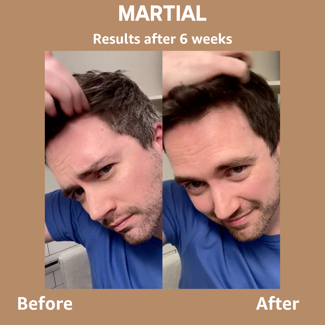 Keilini™ Gray Hair Bamboo Charcoal Bar