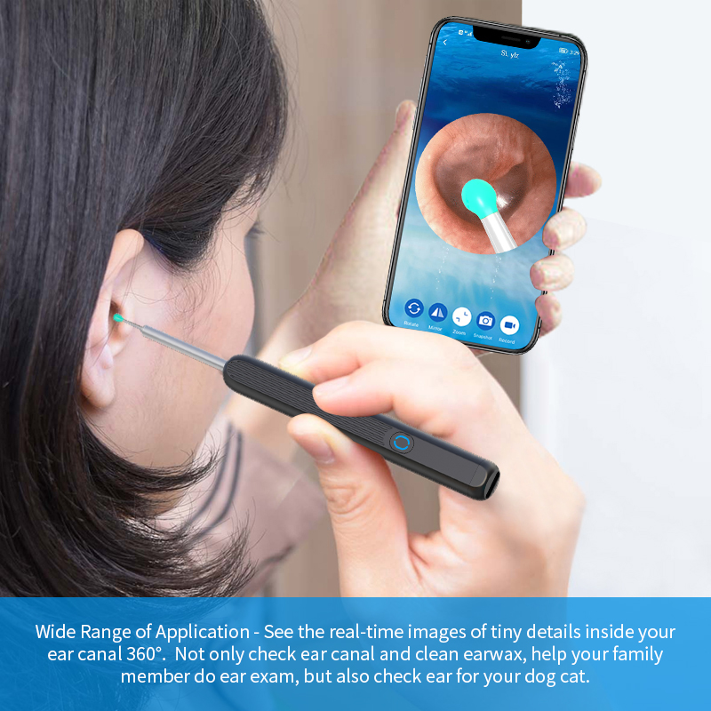 Wi -Fi visible ear wax remover, USB 1080P HD load otoscope (BUY