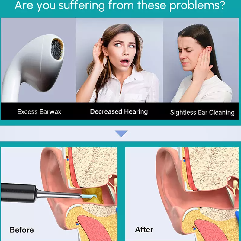 Wi -Fi visible ear wax remover, USB 1080P HD load otoscope (BUY