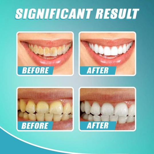 Intensive Stain Removal Whitening Toothpaste Fiitobeauty