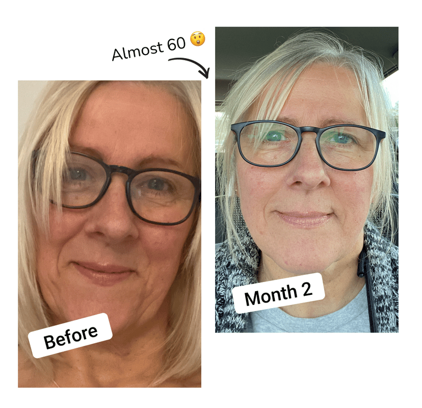 skin collagen before and after with vegan collagen supplements