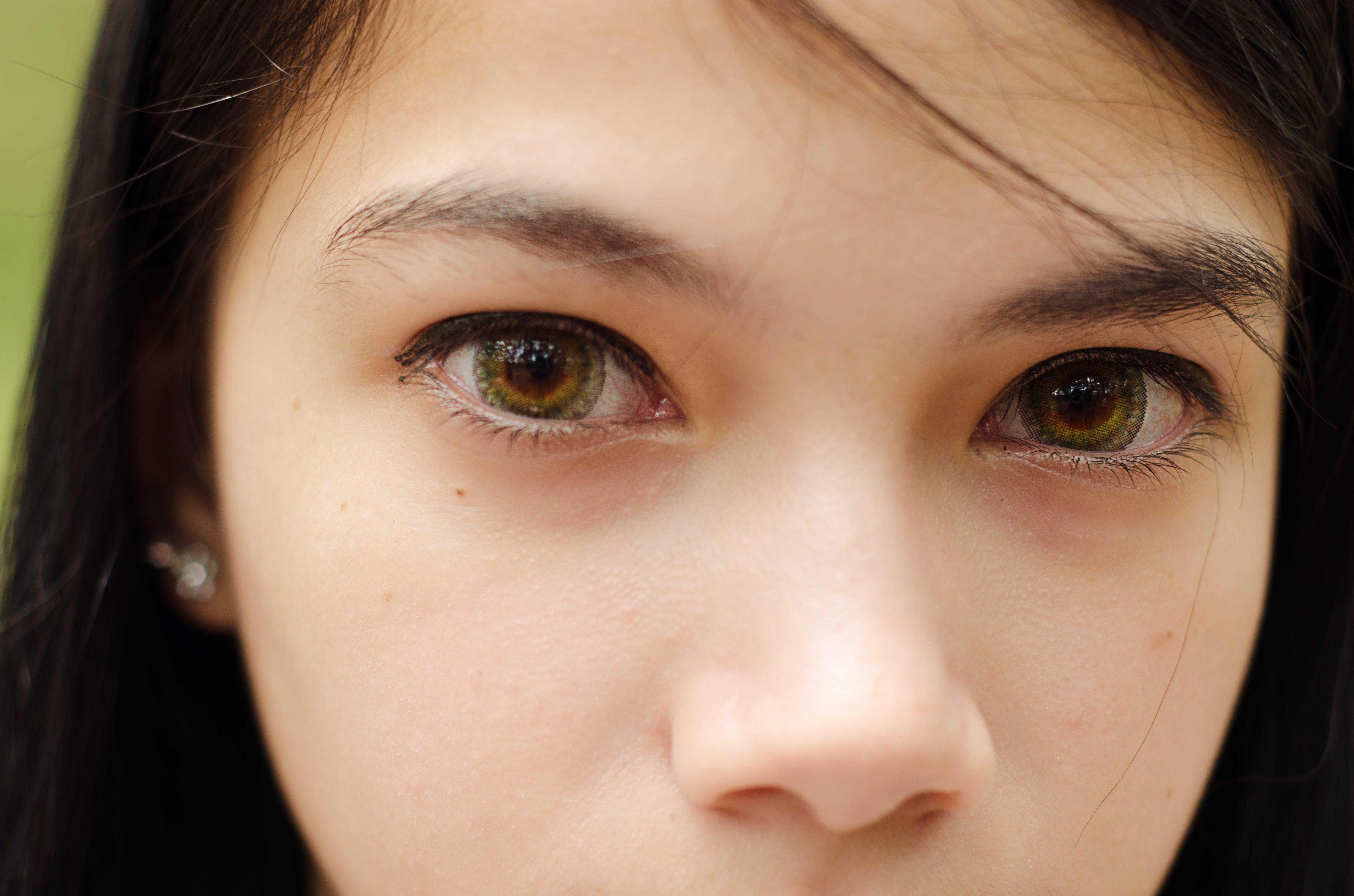 How to Get Stuck Contact Lens Out (with Emergency Tips)-MYEYEBB