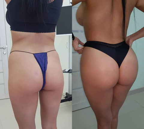 Flashing™ Butt Lift e Enhancer Pads