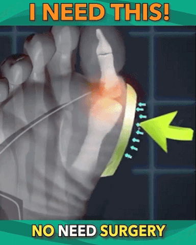 Sandálias corretoras de joanetes ortopédicas premium - sandália feminina com plataforma confortável para correção dos dedos