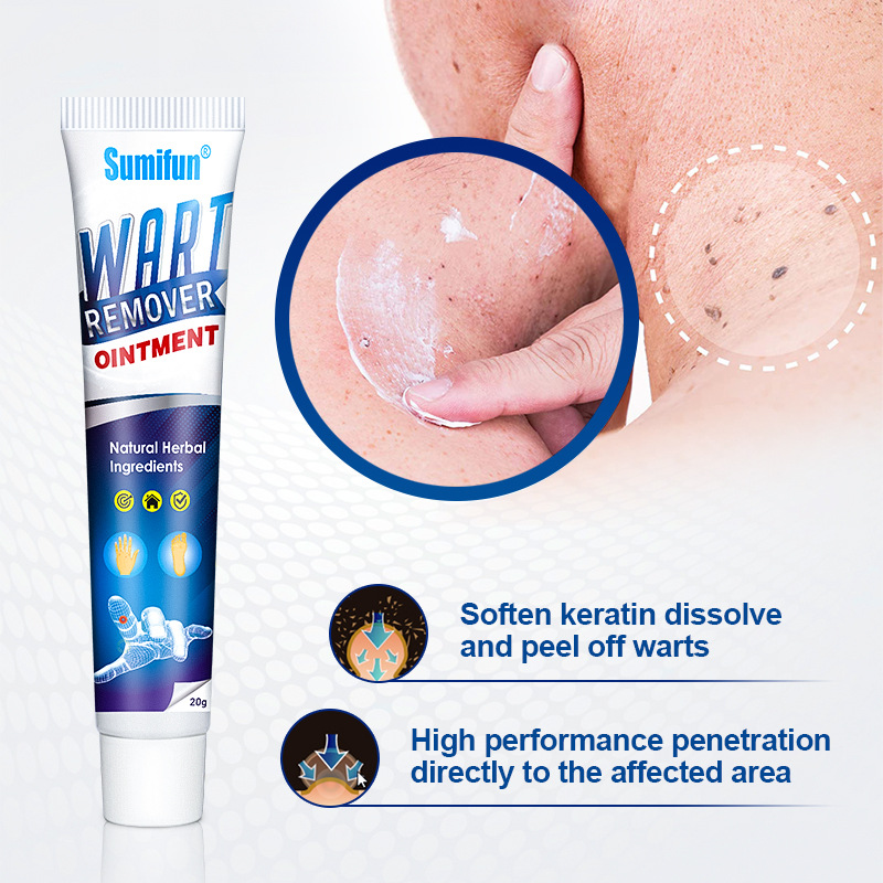 （🔥LAST DAY SALE-30% OFF)Wart Removal Ointment