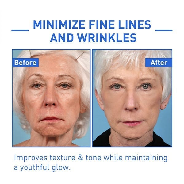 Last Day Promotion 30% OFF - 🔥Botox Face Serum