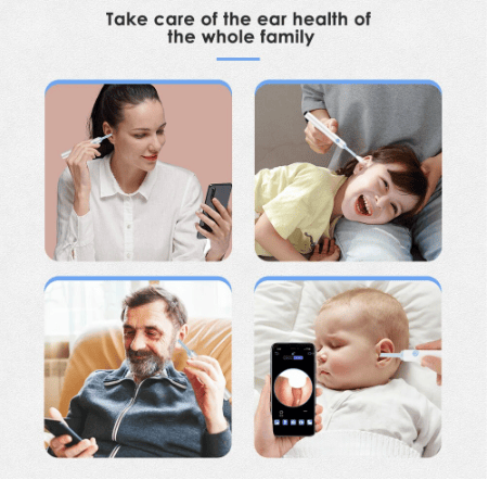 🔥LAST DAY-50%OFF🔥LocalityiTM Clean Earwax-Wi-Fi Visible Wax Removal Spoon, USB 1296P HD Load Otoscope