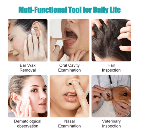 🔥LAST DAY-50%OFF🔥LocalityiTM Clean Earwax-Wi-Fi Visible Wax Removal Spoon, USB 1296P HD Load Otoscope